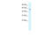 Potassium Two Pore Domain Channel Subfamily K Member 10 antibody, 28-270, ProSci, Western Blot image 