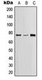 Lymphocyte Cytosolic Protein 2 antibody, LS-C352443, Lifespan Biosciences, Western Blot image 