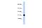 Ubiquitin Conjugating Enzyme E2 L3 antibody, PA5-69213, Invitrogen Antibodies, Western Blot image 