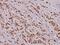 Histone Deacetylase 8 antibody, PA5-36648, Invitrogen Antibodies, Immunohistochemistry paraffin image 