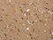 Fatty Acid Binding Protein 2 antibody, CSB-PA826268, Cusabio, Immunohistochemistry frozen image 