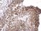 RuvB Like AAA ATPase 2 antibody, NBP1-33599, Novus Biologicals, Immunohistochemistry paraffin image 