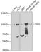 Trimethylguanosine Synthase 1 antibody, A03983, Boster Biological Technology, Western Blot image 