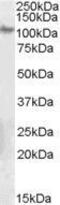 Integrin Subunit Beta 5 antibody, GTX89579, GeneTex, Western Blot image 