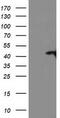 TBC1 Domain Family Member 21 antibody, TA503710, Origene, Western Blot image 