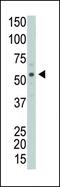 Protein Interacting With PRKCA 1 antibody, PA5-13840, Invitrogen Antibodies, Western Blot image 