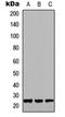 Transmembrane Serine Protease 15 antibody, orb234832, Biorbyt, Western Blot image 