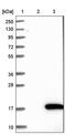 NOTCH Regulated Ankyrin Repeat Protein antibody, PA5-55248, Invitrogen Antibodies, Western Blot image 