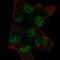 Ubiquitin Conjugating Enzyme E2 V1 antibody, NBP2-58322, Novus Biologicals, Immunofluorescence image 
