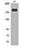 Insulin Receptor Substrate 1 antibody, orb159550, Biorbyt, Western Blot image 