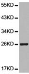 Thy-1 Cell Surface Antigen antibody, TA321756, Origene, Western Blot image 