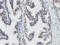 N-Myristoyltransferase 2 antibody, NBP2-01676, Novus Biologicals, Immunohistochemistry paraffin image 