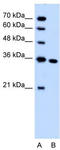 Solute Carrier Family 25 Member 29 antibody, TA334132, Origene, Western Blot image 