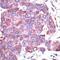 Heat Shock Protein Family A (Hsp70) Member 5 antibody, PA1-37805, Invitrogen Antibodies, Immunohistochemistry frozen image 