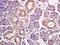 GLIS Family Zinc Finger 3 antibody, orb183858, Biorbyt, Immunohistochemistry paraffin image 