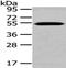 Transcobalamin 2 antibody, PA5-51243, Invitrogen Antibodies, Western Blot image 