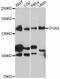 Integrin Subunit Alpha 5 antibody, MBS125415, MyBioSource, Western Blot image 