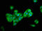 Patatin Like Phospholipase Domain Containing 5 antibody, LS-C674474, Lifespan Biosciences, Immunofluorescence image 