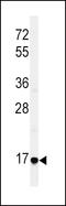 Epiregulin antibody, LS-C167801, Lifespan Biosciences, Western Blot image 