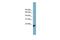 Peroxiredoxin Like 2B antibody, GTX45666, GeneTex, Western Blot image 