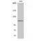 ATPase Sarcoplasmic/Endoplasmic Reticulum Ca2+ Transporting 1 antibody, LS-C386023, Lifespan Biosciences, Western Blot image 