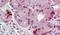 Integrin Subunit Alpha 6 antibody, PA5-32884, Invitrogen Antibodies, Immunohistochemistry paraffin image 