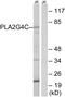 Cytosolic phospholipase A2 gamma antibody, PA5-39128, Invitrogen Antibodies, Western Blot image 