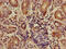 Angiopoietin Like 7 antibody, CSB-PA001715LA01HU, Cusabio, Immunohistochemistry paraffin image 
