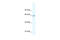 Metal regulatory transcription factor 1 antibody, 27-481, ProSci, Western Blot image 