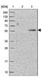 Katanin Catalytic Subunit A1 Like 2 antibody, NBP2-30452, Novus Biologicals, Western Blot image 