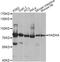 Hydroxyacyl-CoA Dehydrogenase Trifunctional Multienzyme Complex Subunit Alpha antibody, A13310, ABclonal Technology, Western Blot image 