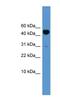 Bone Morphogenetic Protein 10 antibody, NBP1-69112, Novus Biologicals, Western Blot image 