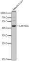 Calcium Voltage-Gated Channel Auxiliary Subunit Gamma 4 antibody, 23-044, ProSci, Western Blot image 