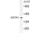 Somatostatin Receptor 1 antibody, LS-C177411, Lifespan Biosciences, Western Blot image 