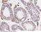 Piwi Like RNA-Mediated Gene Silencing 1 antibody, 100542-T08, Sino Biological, Immunohistochemistry paraffin image 