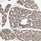 Interleukin 18 Receptor 1 antibody, HPA007615, Atlas Antibodies, Immunohistochemistry paraffin image 