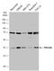 AKT1 Substrate 1 antibody, GTX118391, GeneTex, Western Blot image 
