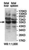Zinc Finger Protein 439 antibody, orb78115, Biorbyt, Western Blot image 
