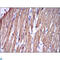 Troponin I2, Fast Skeletal Type antibody, LS-C812791, Lifespan Biosciences, Immunohistochemistry paraffin image 