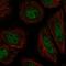 Zinc Finger Protein Y-Linked antibody, HPA071863, Atlas Antibodies, Immunocytochemistry image 