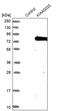 Pumilio RNA Binding Family Member 3 antibody, PA5-51704, Invitrogen Antibodies, Western Blot image 