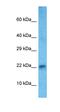 Heart And Neural Crest Derivatives Expressed 2 antibody, orb329577, Biorbyt, Western Blot image 