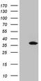 Uridine-cytidine kinase 2 antibody, LS-C794903, Lifespan Biosciences, Western Blot image 