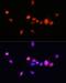 Androgen Receptor antibody, GTX01536, GeneTex, Immunofluorescence image 