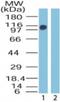 Zinc Finger MYM-Type Containing 2 antibody, NB100-56490, Novus Biologicals, Western Blot image 