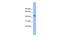 N-Terminal EF-Hand Calcium Binding Protein 3 antibody, PA5-44822, Invitrogen Antibodies, Western Blot image 