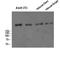 Complement C3b/C4b Receptor 1 (Knops Blood Group) antibody, A01022, Boster Biological Technology, Western Blot image 