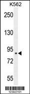 Chloride Intracellular Channel 6 antibody, 55-202, ProSci, Western Blot image 