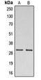 DnaJ Heat Shock Protein Family (Hsp40) Member C5 antibody, orb215300, Biorbyt, Western Blot image 