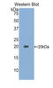 Acid Phosphatase 1 antibody, LS-C301870, Lifespan Biosciences, Western Blot image 